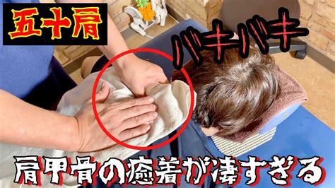 クリトリスの包皮が癒着して痛いのですが、これは病気ですか？。